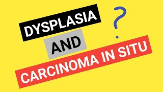 Dysplasia The Progression of Cancer [upl. by Mccafferty]