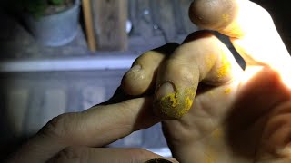 Preventing Infection Of Dry Cracked Finger Skin W Turmeric Powder On City Grime amp Soil Stained Hands [upl. by Darda]