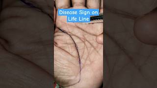 Disease Sign on Life Line palmistry astrology jyotish viral sucess hastrekha disease life [upl. by Saraiya856]