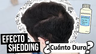 Cuánto TARDA el EFECTO SHEDDING por MINOXIDIL FINASTERIDE e INJERTO CAPILAR en DESAPARECER [upl. by Kosel]