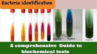 Identify Bacteria FAST with this Biochemical Test Microbiology [upl. by Shanie570]