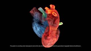 Siemens Healthineers Digital Twin of the Heart [upl. by Aidualc]