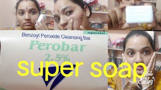 How to remove Pimples in one day perobar super solution in telugu [upl. by Yennek455]