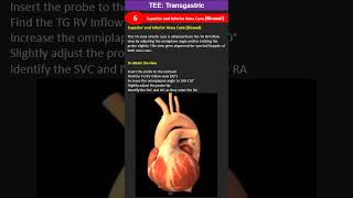 TEE Transgastric Superior and Inferior Vena Cava Bicaval [upl. by Adnawyek]