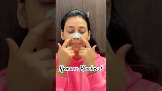 Blackhead Removal  Nose blackhead  Nose blackhead removal  Porestrips  skincare blackheads [upl. by Rosie154]