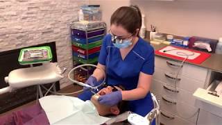 Teeth polishing What is teeth polishing What do dentists use to polish teeth [upl. by Suivatnom]