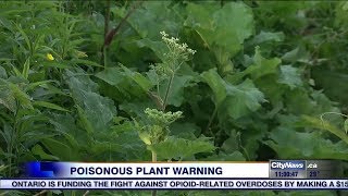 Poisonous tall plant growing in GTA causes burning rashes [upl. by Radnaskela]