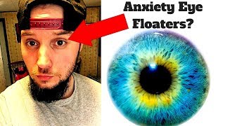 Anxiety Eye Floaters ANNOYING [upl. by Lirrad]