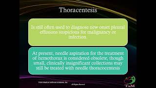 Hemothorax review [upl. by Mountfort141]