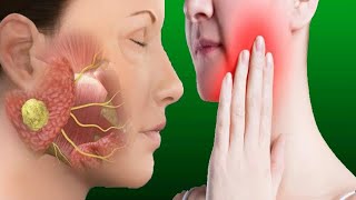 Salivary Gland Infection Causes And Treatment [upl. by Elkin]