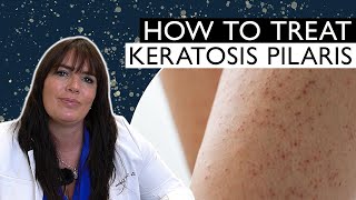 How to Effectively Treat and Remove Chicken Skin Keratosis Pilaris [upl. by Stroup]