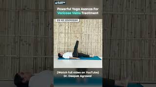 Yoga Exercise for Varicose Vein at Home  Part 8 yogaasanas varicoseveins [upl. by Esikram]