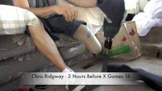 Chris Ridgway 2010 X Games [upl. by Nets]