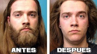 40 HOMBRES ANTES Y DESPUÉS DE AFEITARSE LA BARBA QUE TE SORPRENDERÁN [upl. by Lokcin]