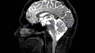 Sagittal T2 of the Brain from Imaging Anatomy of the Human Brain [upl. by Lladnyk693]