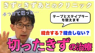 【よくある疑問にもお答え！】切った時の傷、形成外科でどういう治療をするのか？ [upl. by Pyle]