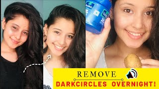 Bye To Dark CirclesGet Rid of Dark Circles Naturally 100 works  KTZX [upl. by Morra652]