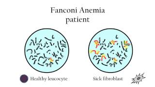 Fanconi Anemia  Genetic diagnosis [upl. by Karlee]