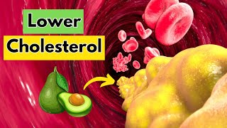 10 Foods to Lower LDL Cholesterol Levels [upl. by Celisse]