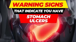 top 10 warning signs of stomach ulcers [upl. by Pich]