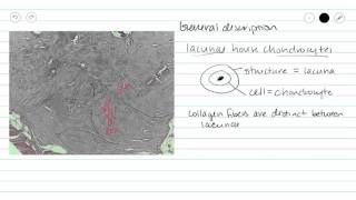 Fibrocartilage Fibrous cartilage Connective Tissue [upl. by Cade445]