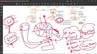 20 Spinothalamic tract [upl. by Jeffrey]