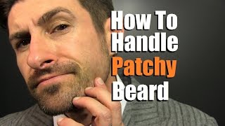 How To Deal With A Patchy Beard  Bald Spot Reduction Tips [upl. by Kirsteni]