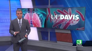 UC Davis says contagious tuberculosis case identified contact tracing underway [upl. by Irallih]