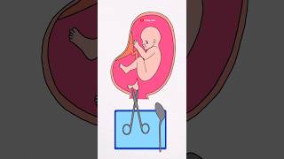 Dont be cruel to your baby 🥺😭 artbylaba shorts shortsfeed deepmeaning animationvideo [upl. by Ahseila]