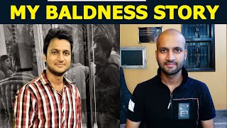 What men goes through during Baldness  Anxiety  Depression  Mental health [upl. by Lucais844]