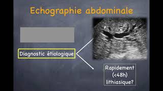 Pancréatite aiguë  1 Diagnostic positif [upl. by Filip552]