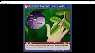 Type IV 4 Hypersensitivity [upl. by Redd677]