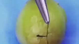 Surgery on a grape 🍇⠀      med surgicalteaching surgery surgeon medical [upl. by Aitret603]