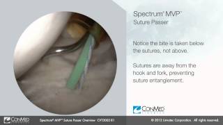 ConMed Linvatec Spectrum® MVP™ Suture Passer Overview [upl. by Wagner]