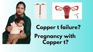 My experience in failure of copper t  pregnant with copper t [upl. by Dripps737]