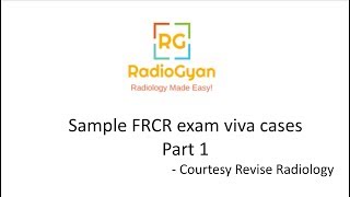 FRCR part 2B viva cases  RadioGyancom  Radiology Made Easy [upl. by Alyhs]