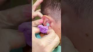 क्यों कानों के अंदर लिक्विड पेस्ट भरा जाता है  3d ear canal shape [upl. by Ennayehc832]