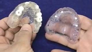 Radiographic and Surgical Implant Templates for the Completely Edentulous Fabrication Technique [upl. by Wadleigh]