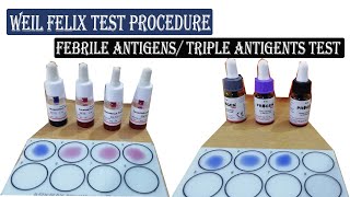 Weil Felix Test ।। Febrile Antigens Triple Antigens Test Procedure Full Details [upl. by Lledal]