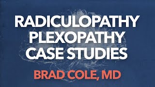 Radiculopathy Plexopathy case studies 1 [upl. by Hannavas]