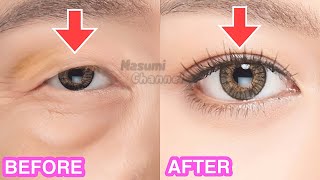 Big Eye Massage Make Your Eyes Bigger Naturally Create Double Eyelids Lift Droopy Eyelid [upl. by Hepzi]