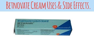 Betnovate Cream for Skin Problems – Everything You Need to Knowquot [upl. by Pelagia]