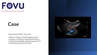 Chronic Cholangitis [upl. by Ananna]