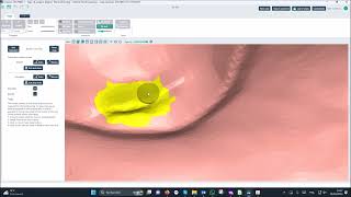 Cleaning the dental model with Deltaface Aligner software [upl. by Cade]