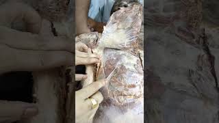 Dissection of Pectoral region [upl. by Llerahc]