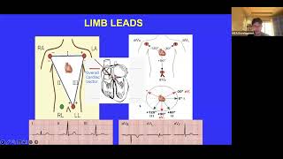 ECG Crash Course Pt 1 I Raffi AlMutawa I CVP 351 PAL review session [upl. by Attenev418]