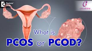 What is PCOS or PCOD  Dr Bandita Sinha of Cloudnine Hospitals  Doctors Circle [upl. by Milas112]