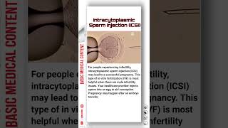 Intracytoplasmic Sperm Injection ICSI icsi ivf pregnancy sperm [upl. by Aneehta]