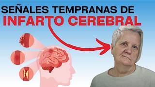 10 Señales de que vas a tener un infarto cerebral [upl. by Genesa]