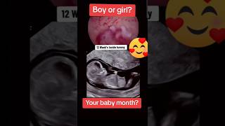 12 weeks baby moving inside mothers womb pregnancy🥰🥰viralvideo trending baby [upl. by Esital]